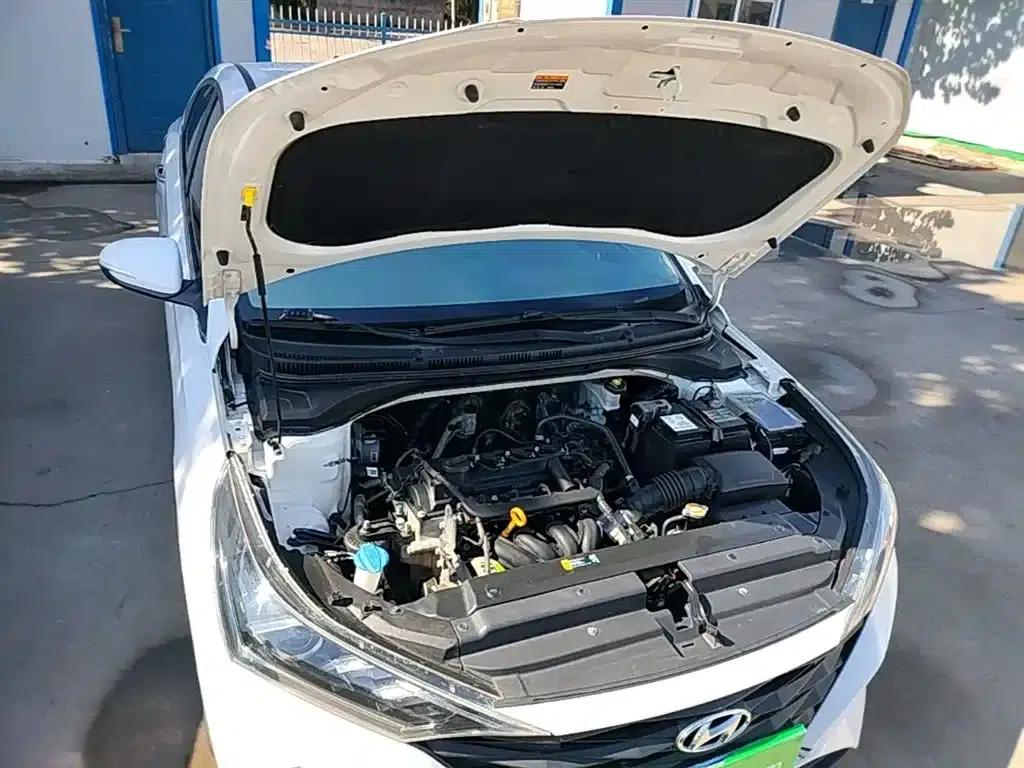 2020 Hyundai Verna 1.4L Manual GLS Cool Edition — миниатюра 20