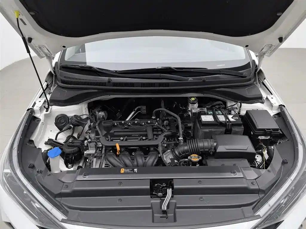 2020 Hyundai Verna 1.4L Manual GLS Cool Edition — миниатюра 6